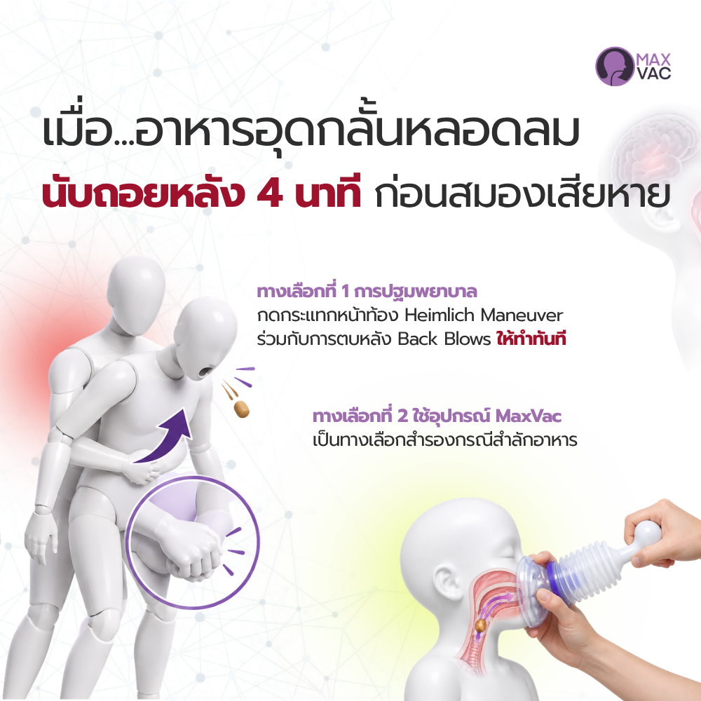 MaxVac: เครื่องช่วยผู้สำลักอาหาร